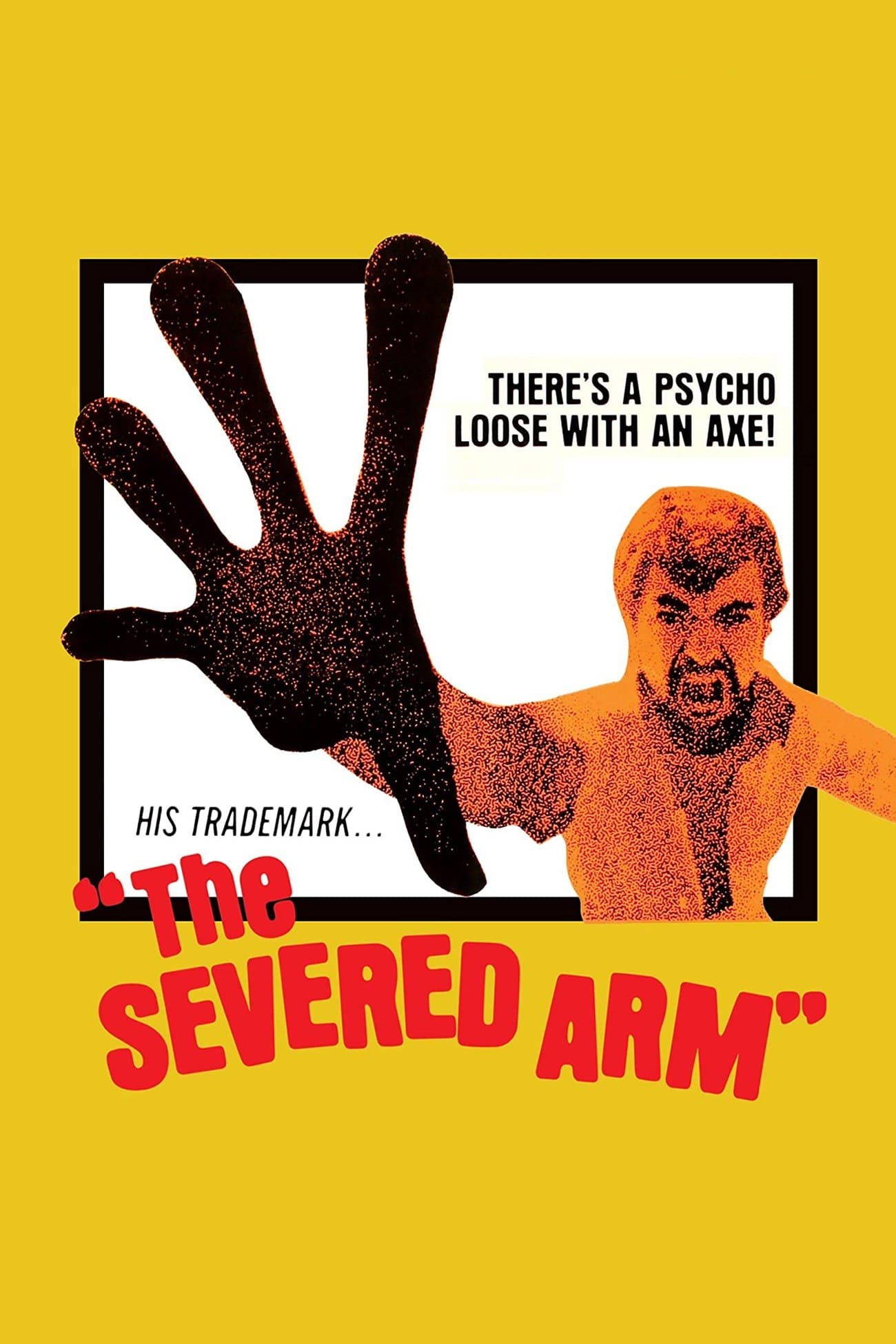 The Severed Arm