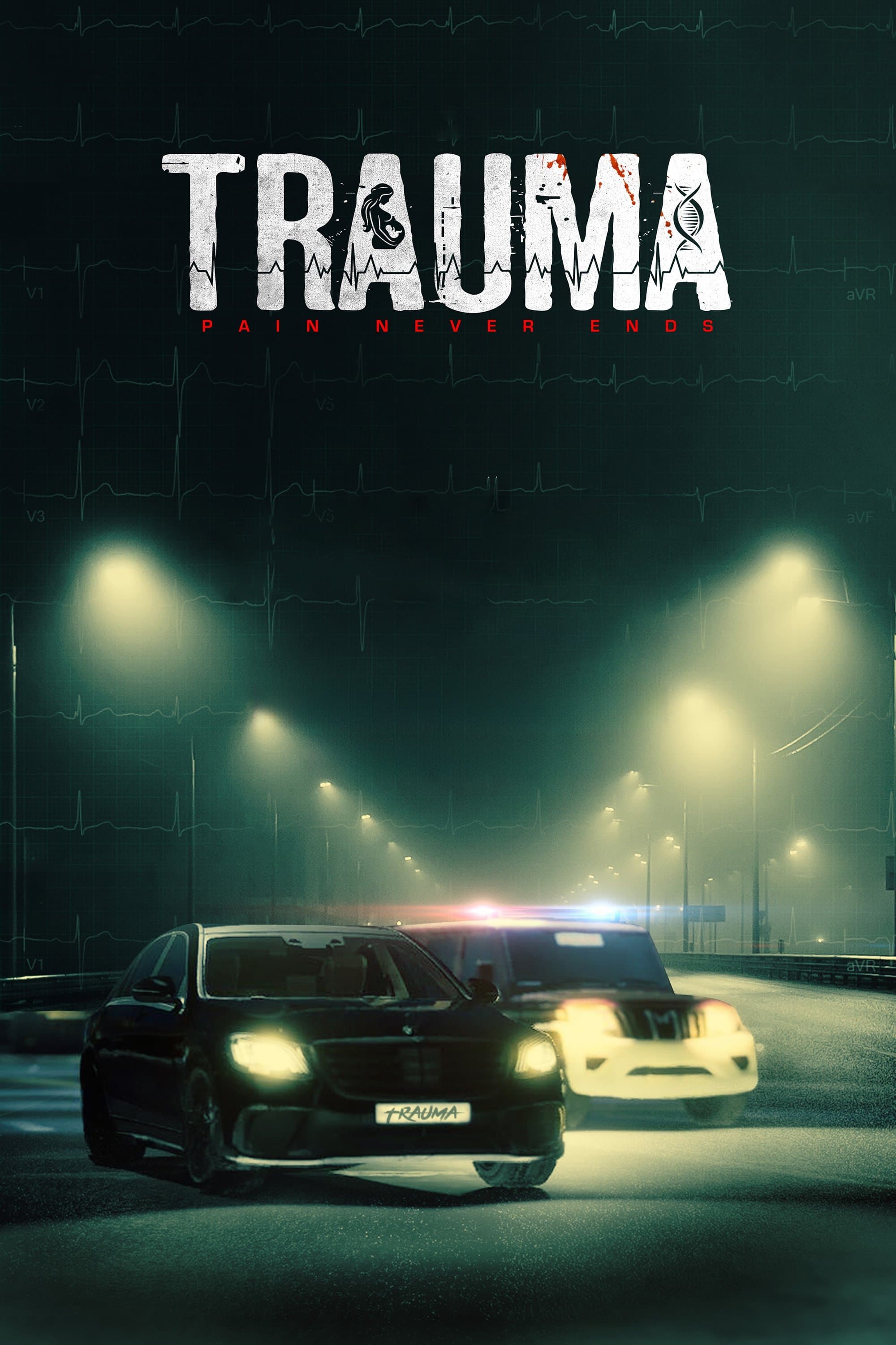 Trauma
