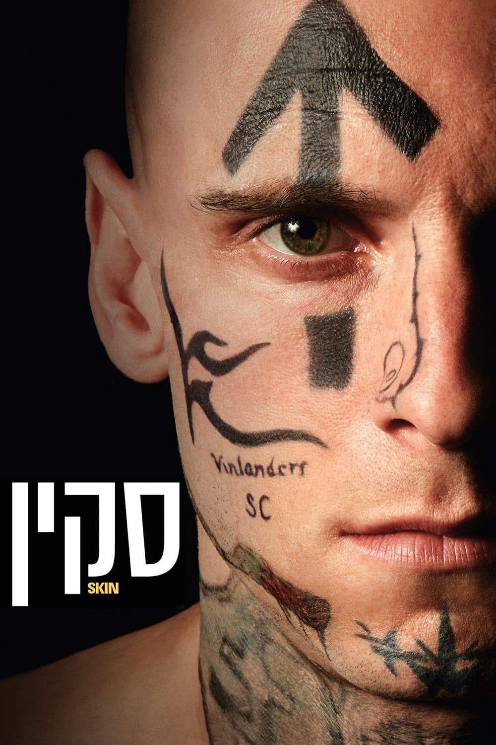 סקין