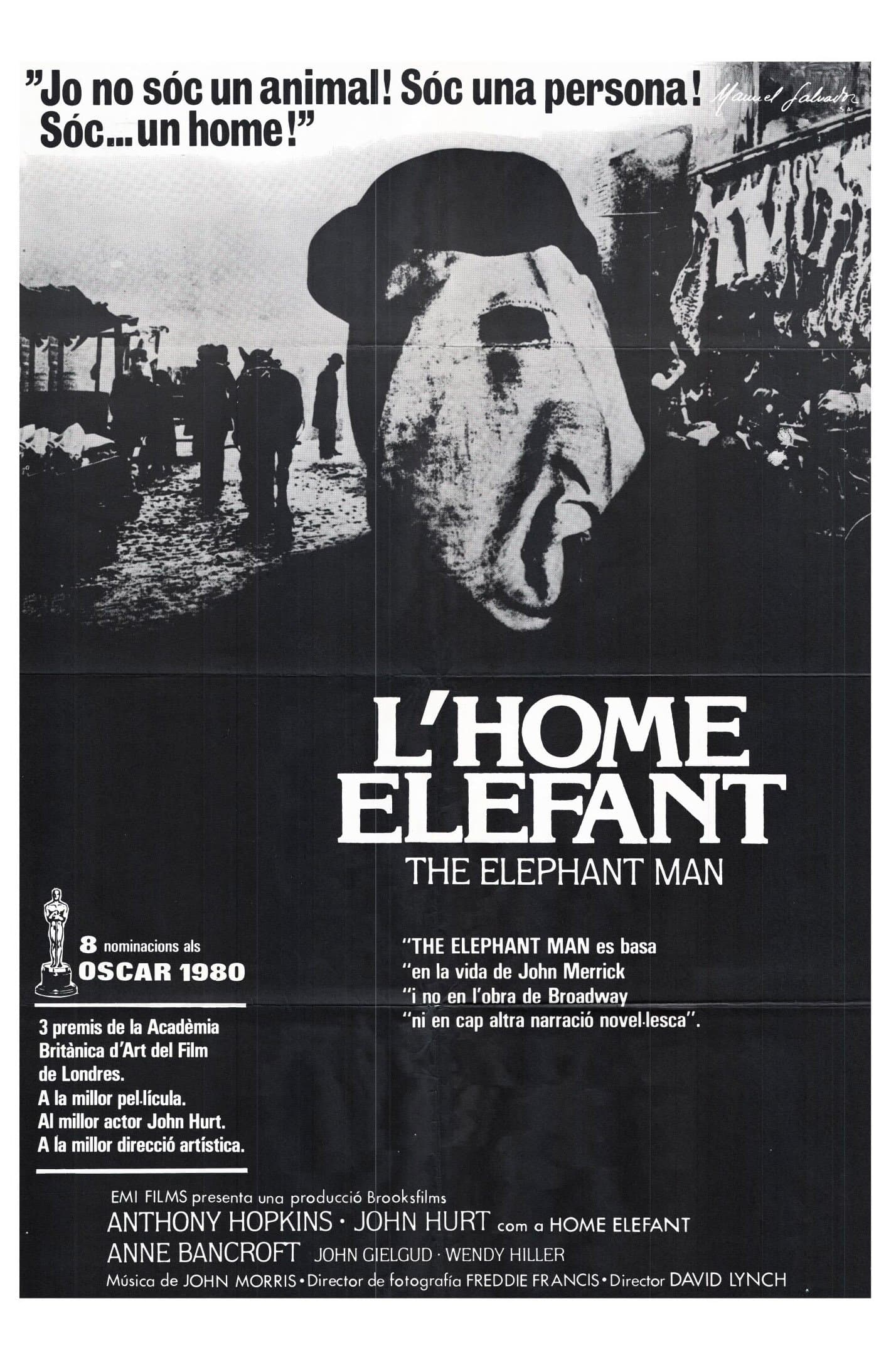 L'home elefant