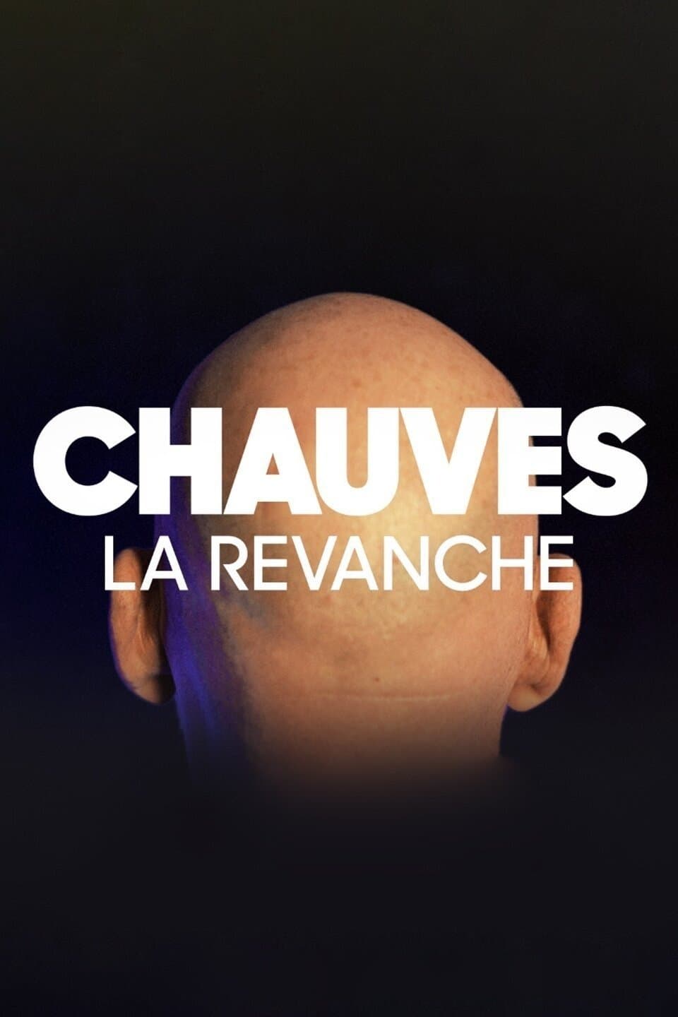 Chauves, la revanche